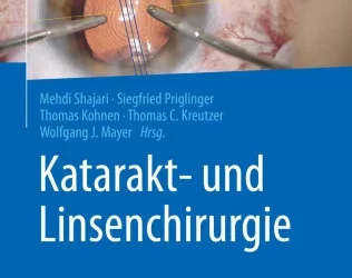 Buch Katarakt Chirurgie